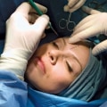 What does cosmetic surgeon mean?
