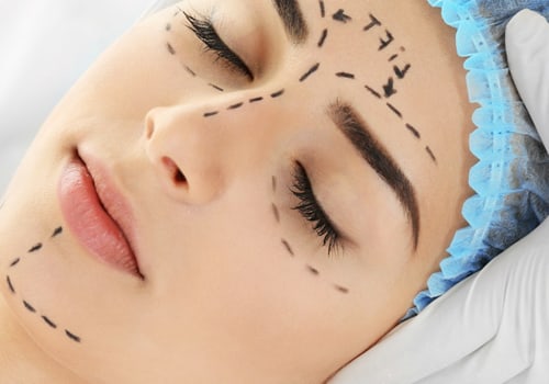 Is cosmetic surgery permanent?