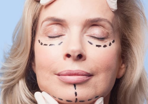 Is cosmetic surgery a qualified medical expense?