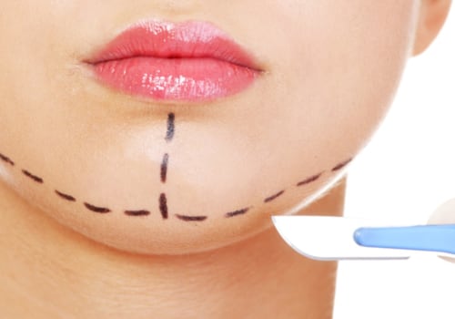 Does plastic surgery change your personality?